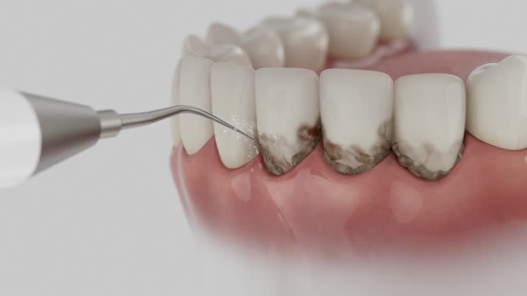 Reliable Dental contractor in Jonesboro, IN by Dentist Open Now